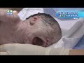 光あれ...新生児集中治療室は今...。命の最前線で戦う医師...病室を安らげる場所に LED治療