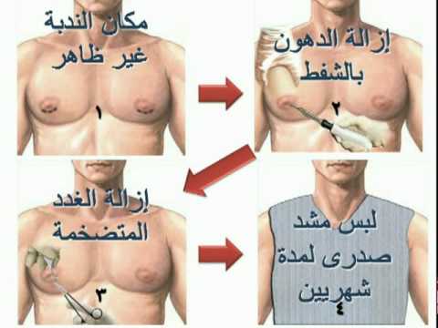 زب
