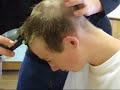 baldy slaphead baldy slaphead