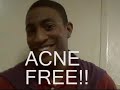 Carlton Banks for Zit-B-Gone