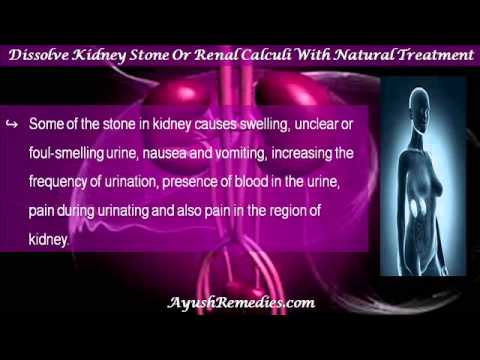 how to dissolve urinary stones