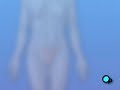 PreOp® Patient Education Myomectomy Vaginal Fibroid  Surgery