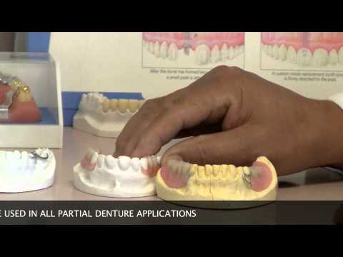how to whiten partials