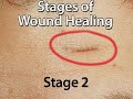 Advanced Skin Care