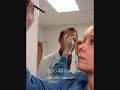 Botox Cosmetic Surgery - Dr. Samuel Shatkin Jr. Part II Botox Cosmetic Surgery - Dr. Samuel Shatkin Jr. Part II