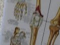 Dunking Bones ***increase vertical jump *** or turn to dust Dunking Bones ***increase vertical jump *** or turn to dust