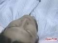 Quit Smoking with Acupuncture