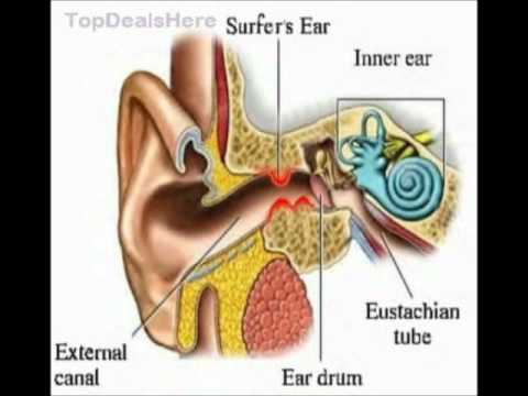 how to unclog ears after skydiving