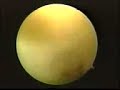 KNEE SURGERY VIDEO