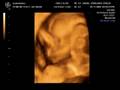 Babbo 4D (20w5d)