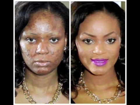 How To | Acne Coverage Foundation Routine