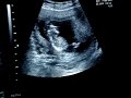 Este es nuestro hermoso Bebe tiene tres meses y medio ... Se los presento ....