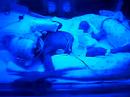 Anthony under the bilirubin light 4 days after birth Bilirubin
