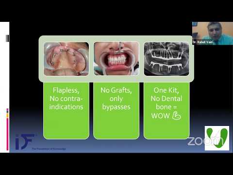 LIVE Webinar : CORTICO-BASAL Implants: A Tectonic shift in Implantology