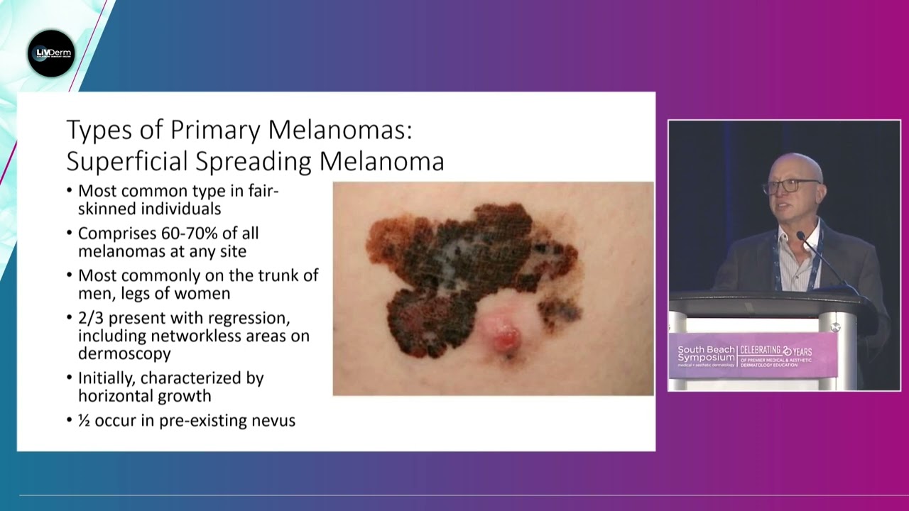 Treatment Guidelines for Melanoma and NMSC - David Goldberg, MD, JD