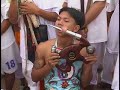 3- Strange & bizarre Face Piercing 3- Strange & bizarre Face Piercing