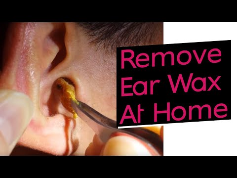 how to drain excess fluid from ear