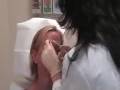 Botox Injection