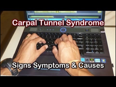 Exercises For Carpal Tunnel Syndrome Relief Pdf