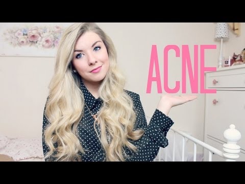 how to clear acne uk