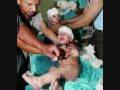 Who will save Gaza's children? Do your bit!