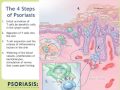 PART 1 - Psoriasis: More Than Skin Deep webcast