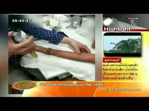 นักศึกษาสาว - หามนักศึกษาสาวม.ดังเข้าโรงพยาบาล หลังฉีดสารเร่งผิวขาวจนเกิดอาการช็อ...