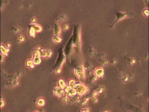 how to isolate erythrocytes