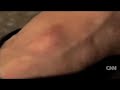 Cuban blogger beaten