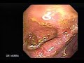 bacteria usil bacteria usil