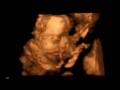 videos de Baby 2 face
