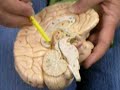 Brain2