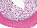 Shotgun Histology Bone Marrow Shotgun Histology Bone Marrow