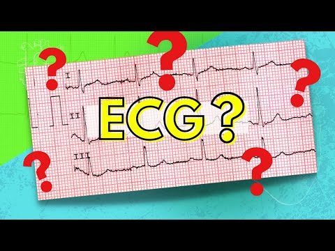 how to properly perform an ecg