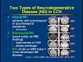 Central Nervous System Involvement in LCH Pt 2 of 3 Central Nervous System Involvement in LCH Pt 2 of 3