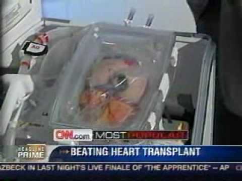 how to transplant a human heart