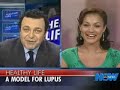 New York OB-GYN Dr. Jacques Moritz discussing lupus disease New York OB-GYN Dr. Jacques Moritz discussing lupus disease