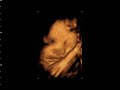 My baby My baby