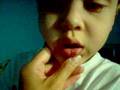 Davids-missing-tooth