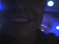 pelone se cayo