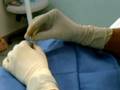 Painful Injections