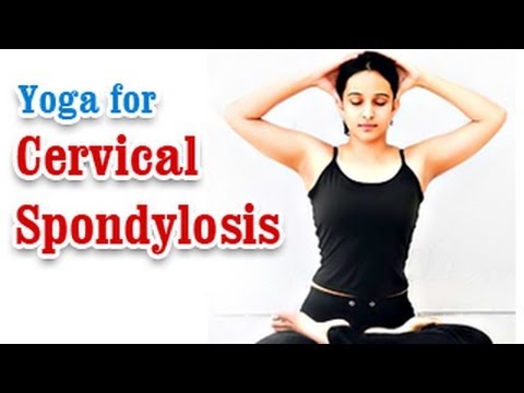 how to cure spondylitis