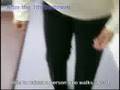 Outcomes of treatment for Parkinson's disease - Ex12(NEW)