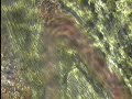 eBAT Arterial Bifurcation