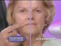 videos de FaceMaster Facial Toning - Facial Toning
