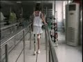 The Chinese amputee girl installs the prosthesis