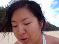 Stung by a Portuguese Man-of-War at Waimanalo Bay