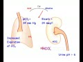 Respiratory Alkalosis