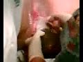 delivery of a baby
