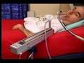 Quadriplegic demonstrates Angel FX ECU